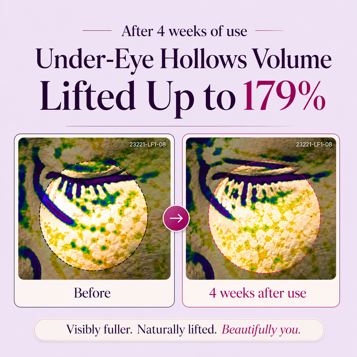 🔥Last Day Buy 1 Get 1 Free Pleasingstore Calcium Brightening Eye Cream